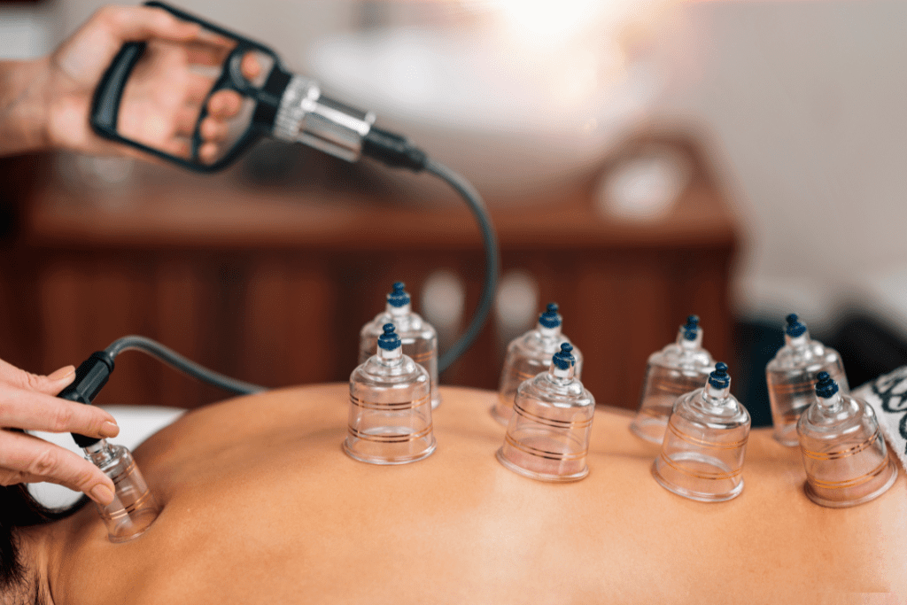 Herts Cupping Dry Cupping